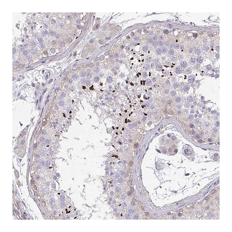 Atlas Antibodies Anti-C19orf54 Antibody