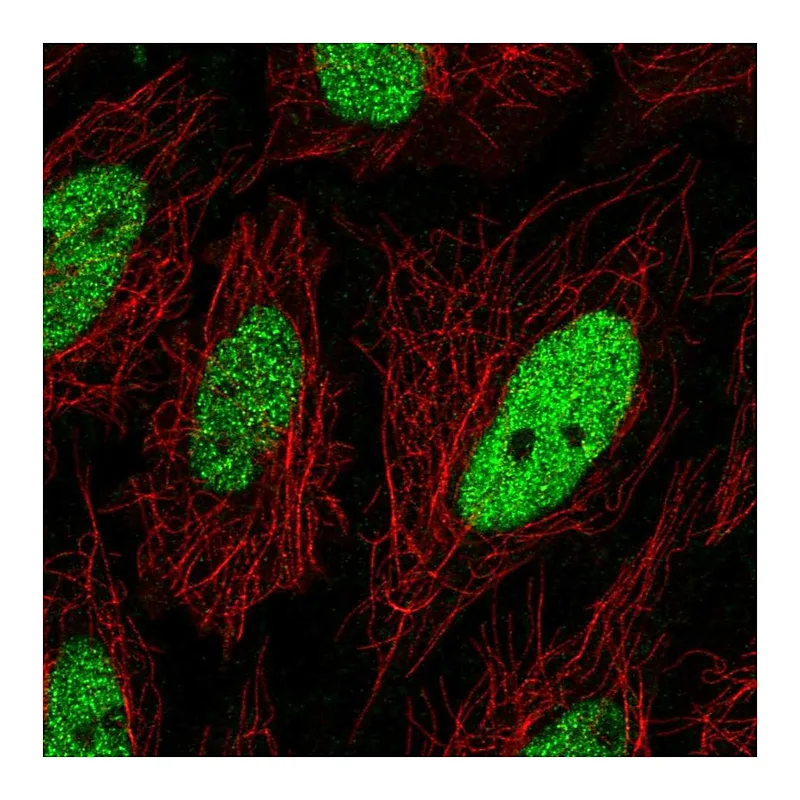Atlas Antibodies Anti-C19orf57 Antibody