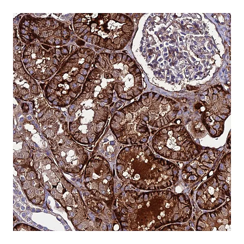 Atlas Antibodies Anti-C19orf60 Antibody