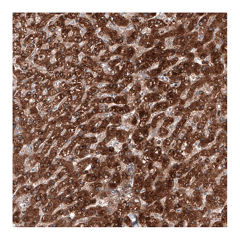 Atlas Antibodies Anti-C19orf66 Antibody