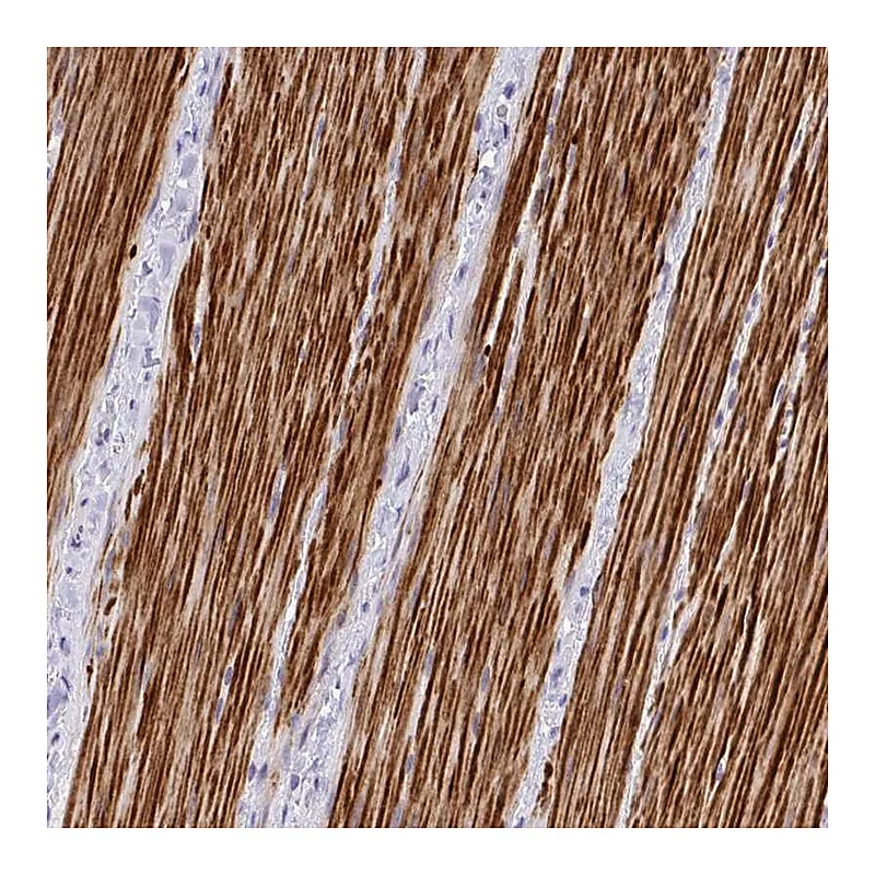 Atlas Antibodies Anti-C19orf68 Antibody