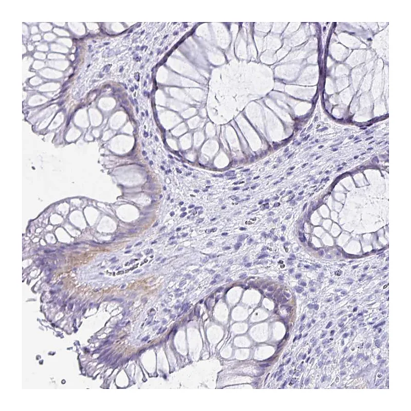Atlas Antibodies Anti-C19orf73 Antibody