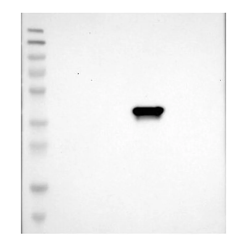 Atlas Antibodies Anti-C1GALT1C1 Antibody