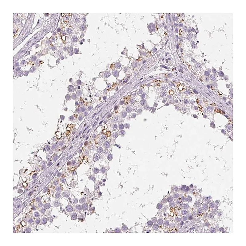 Atlas Antibodies Anti-C19orf84 Antibody
