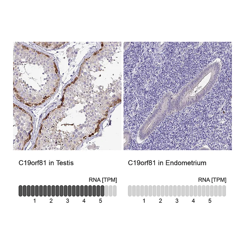 Atlas Antibodies Anti-C19orf81 Antibody
