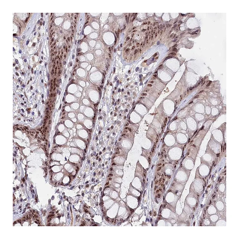 Atlas Antibodies Anti-C1D Antibody
