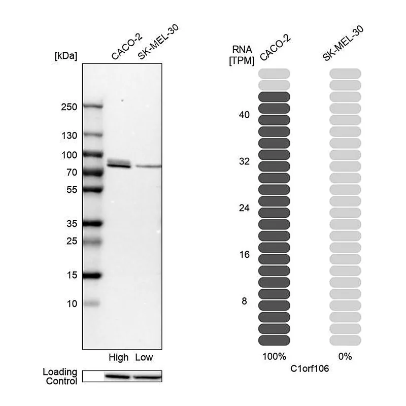 Atlas Antibodies Anti-C1orf106 Antibody