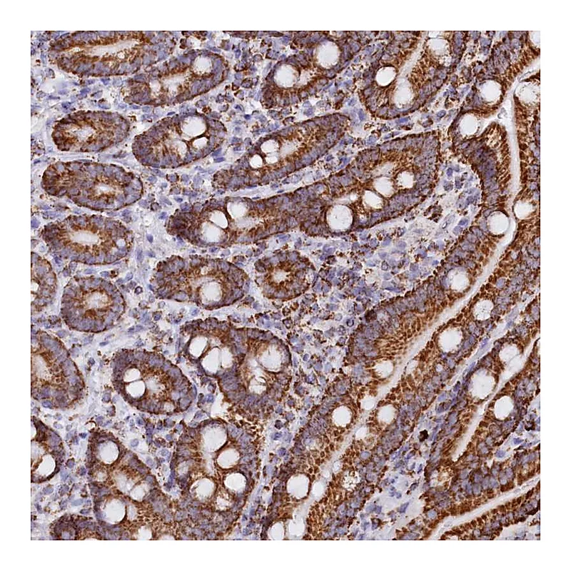 Atlas Antibodies Anti-C1D Antibody