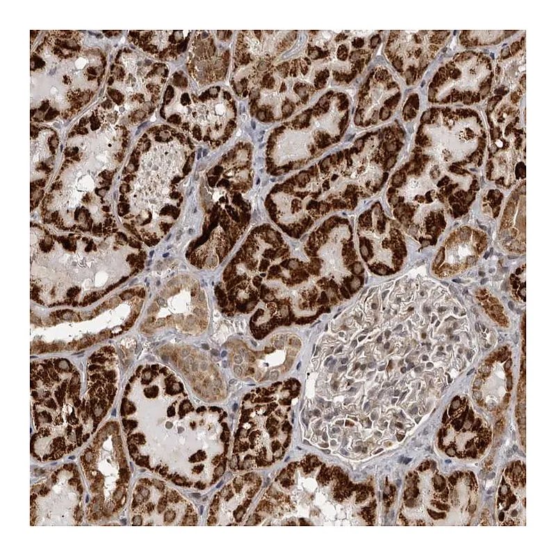 Atlas Antibodies Anti-C1orf109 Antibody
