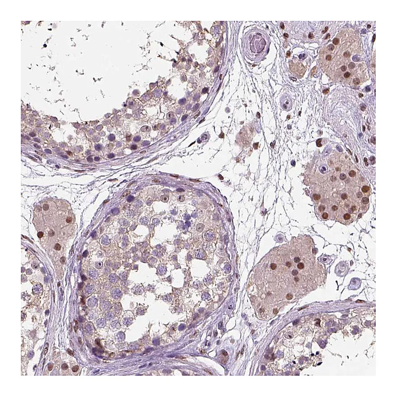 Atlas Antibodies Anti-C1orf112 Antibody