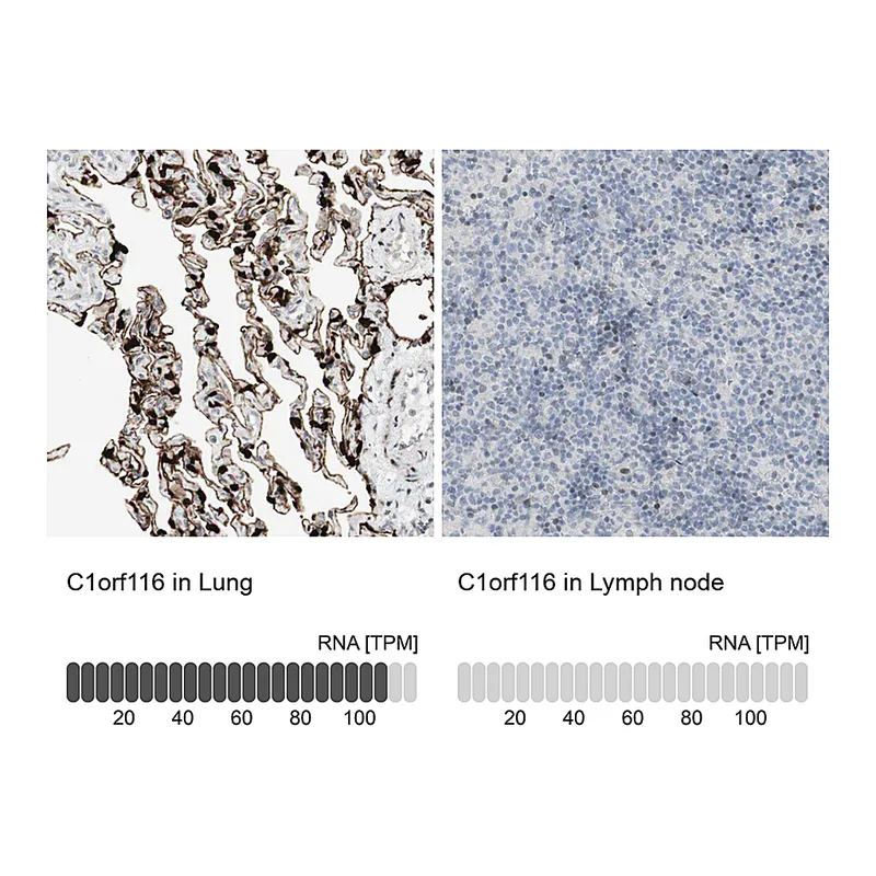 Atlas Antibodies Anti-C1orf116 Antibody