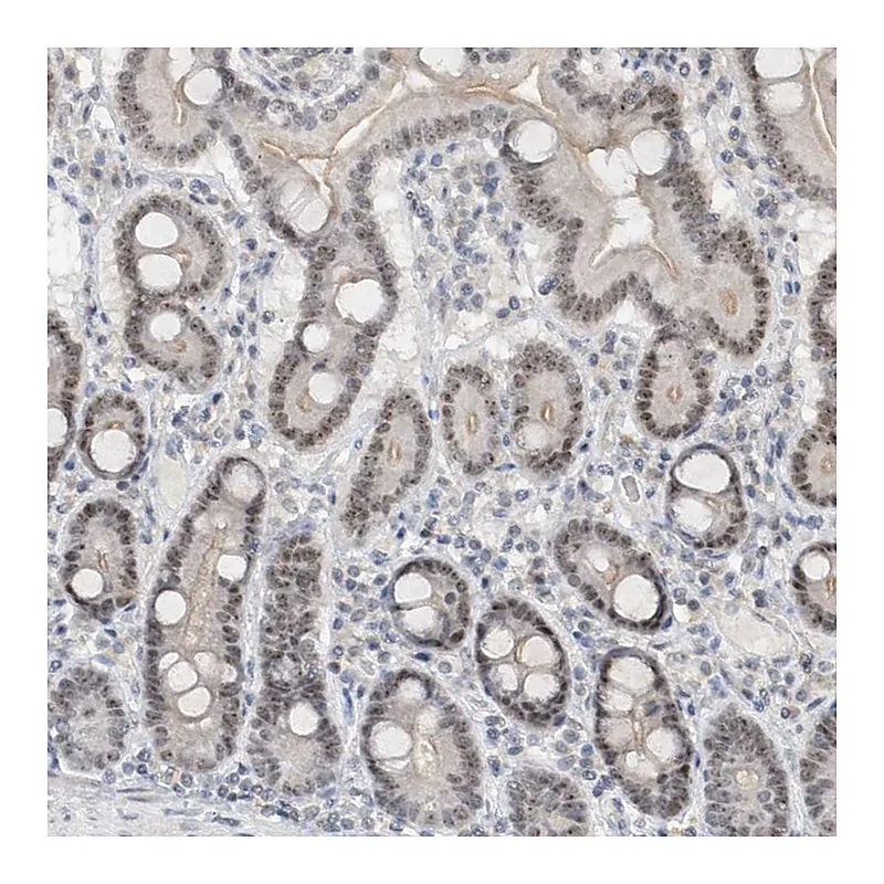 Atlas Antibodies Anti-C1orf131 Antibody