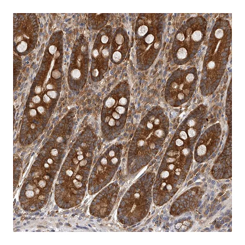 Atlas Antibodies Anti-C1orf109 Antibody