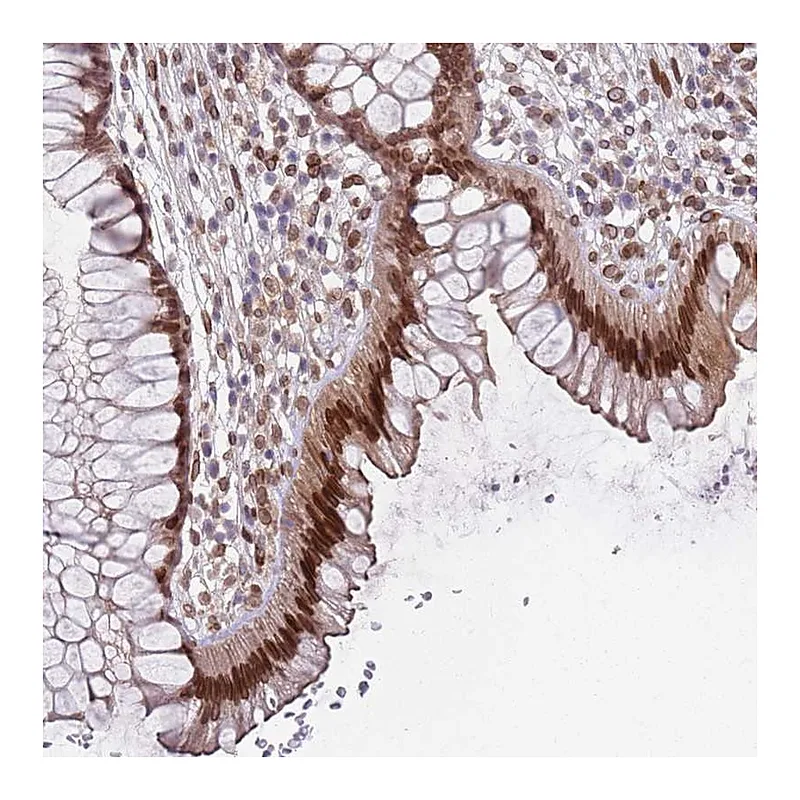 Atlas Antibodies Anti-C1orf145 Antibody