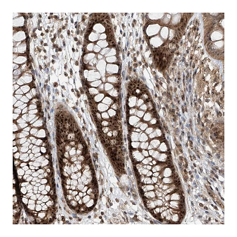 Atlas Antibodies Anti-C1orf131 Antibody