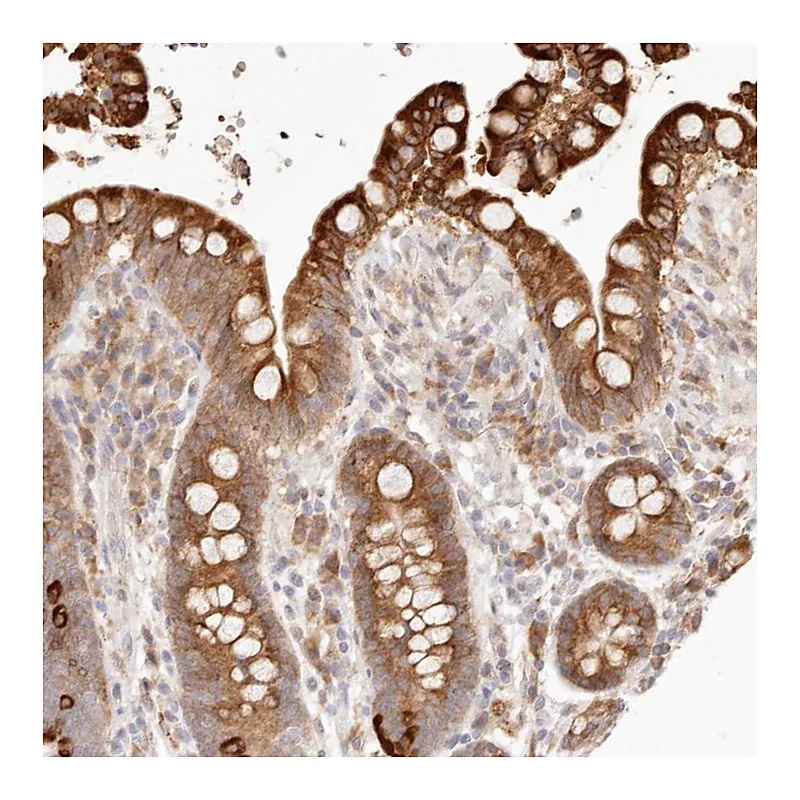 Atlas Antibodies Anti-C1orf127 Antibody