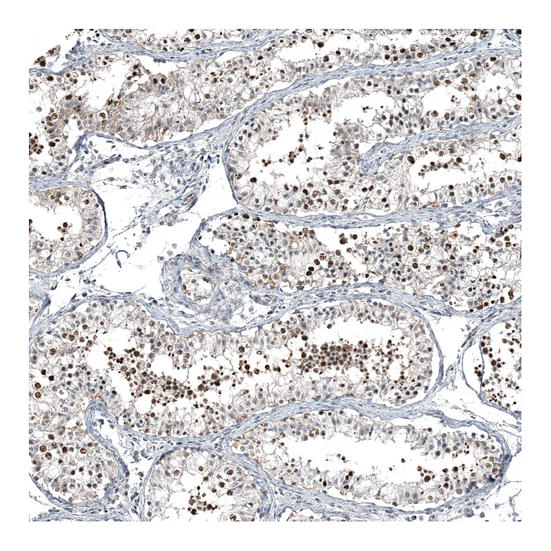 Atlas Antibodies Anti-C1orf112 Antibody