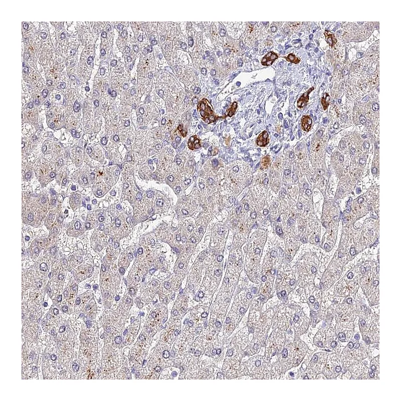 Atlas Antibodies Anti-C1orf123 Antibody