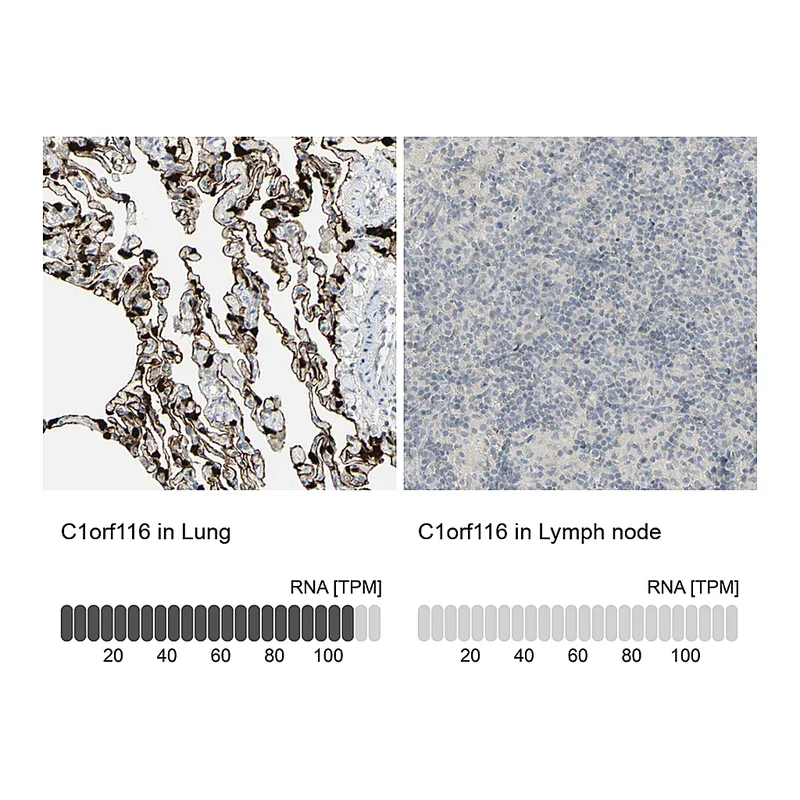 Atlas Antibodies Anti-C1orf116 Antibody
