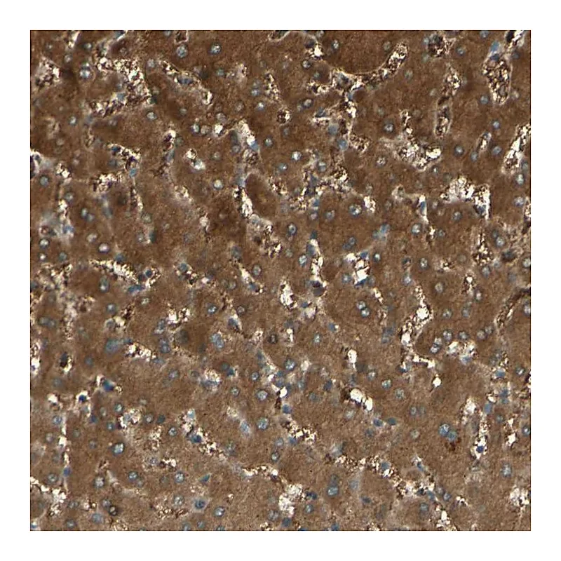 Atlas Antibodies Anti-C1orf159 Antibody