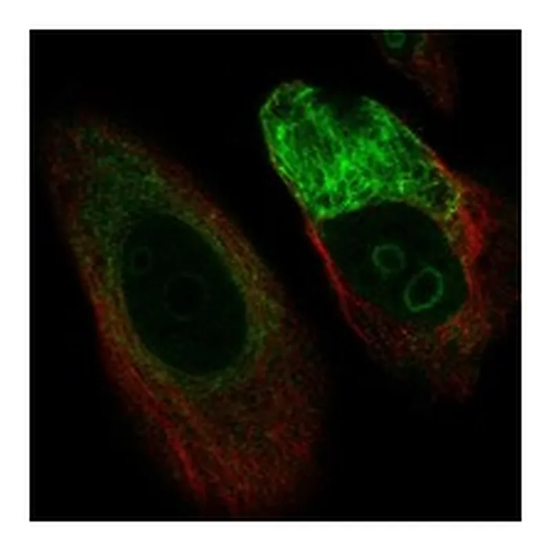 Atlas Antibodies Anti-C1orf159 Antibody