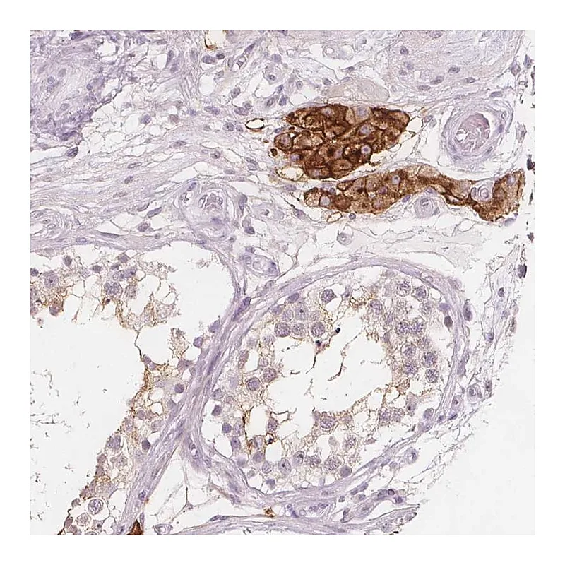 Atlas Antibodies Anti-C1orf167 Antibody