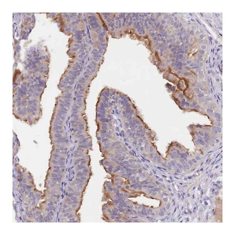 Atlas Antibodies Anti-C1orf189 Antibody