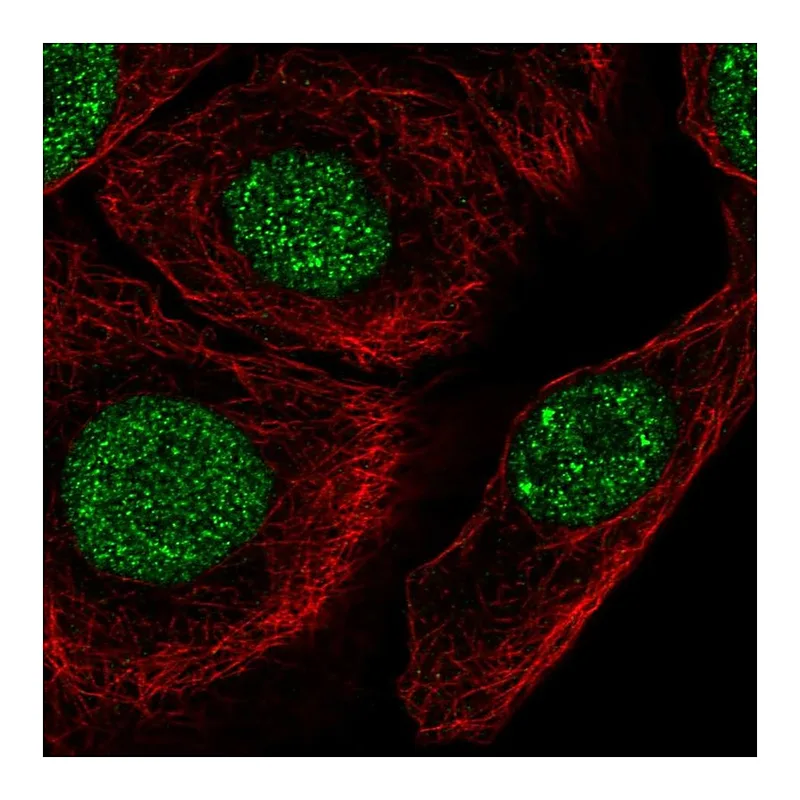 Atlas Antibodies Anti-C1orf174 Antibody
