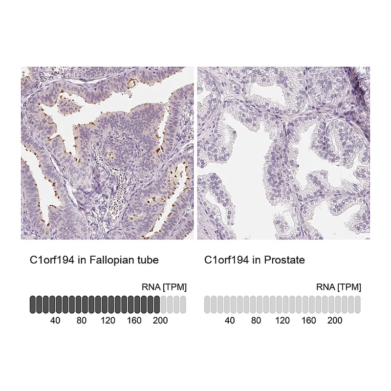 Atlas Antibodies Anti-C1orf194 Antibody