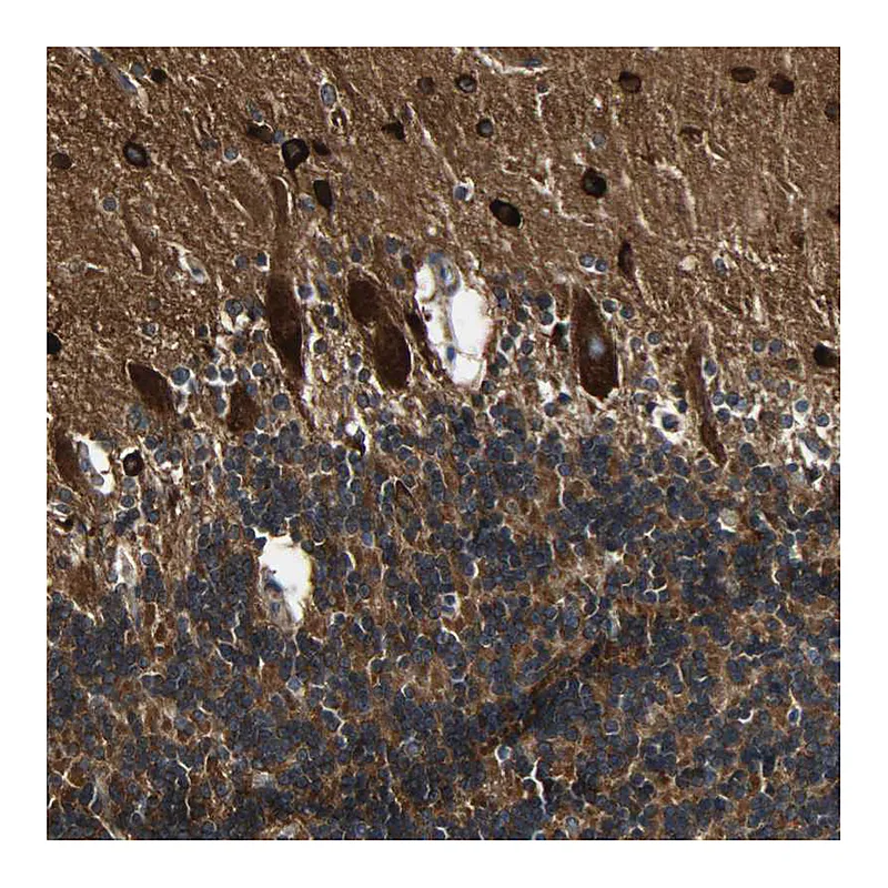 Atlas Antibodies Anti-C1orf198 Antibody