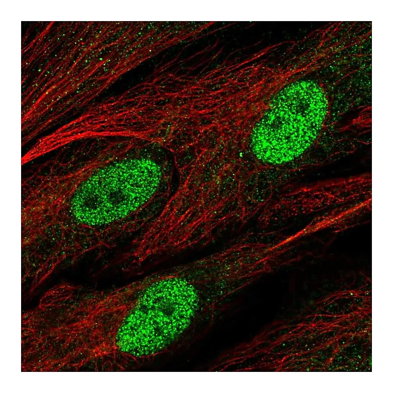 Atlas Antibodies Anti-C1orf204 Antibody