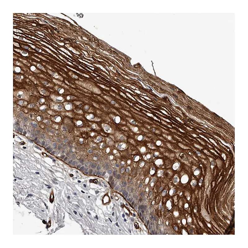 Atlas Antibodies Anti-C1orf216 Antibody
