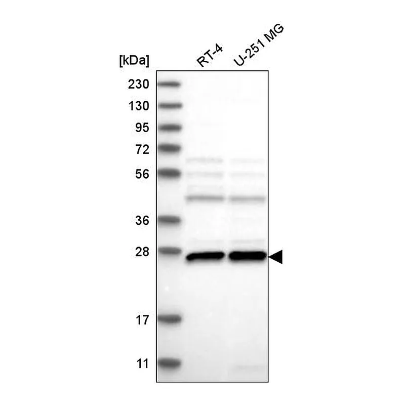 Atlas Antibodies Anti-C1orf216 Antibody