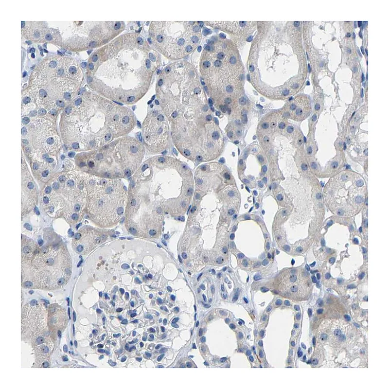 Atlas Antibodies Anti-C1orf210 Antibody
