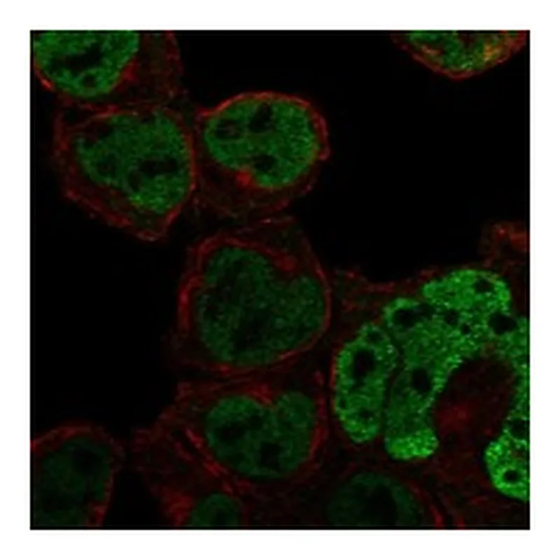 Atlas Antibodies Anti-C1orf226 Antibody
