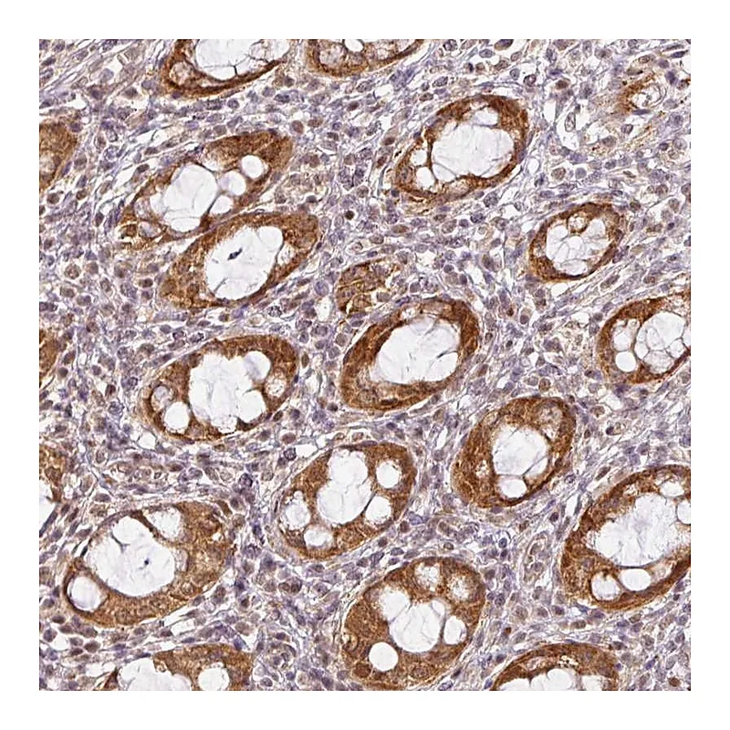 Atlas Antibodies Anti-C1orf226 Antibody