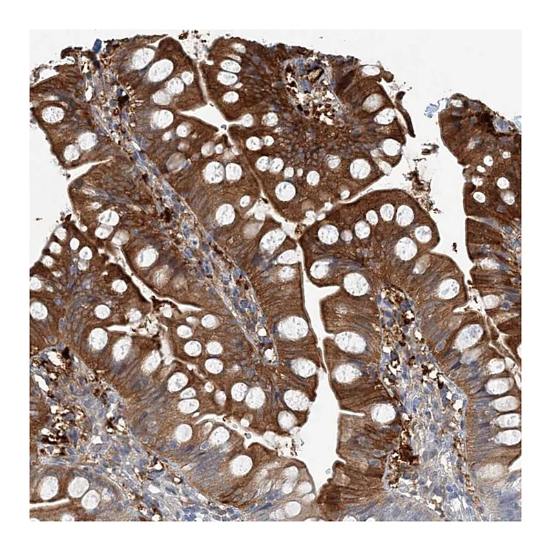 Atlas Antibodies Anti-C1orf228 Antibody