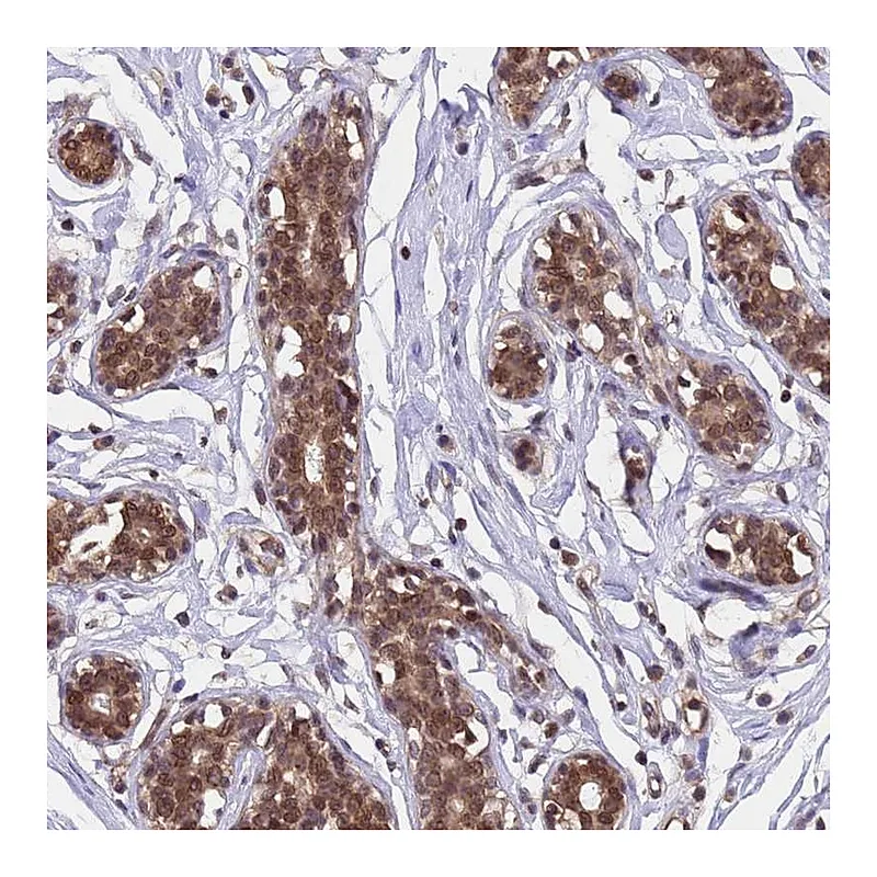 Atlas Antibodies Anti-C1orf35 Antibody