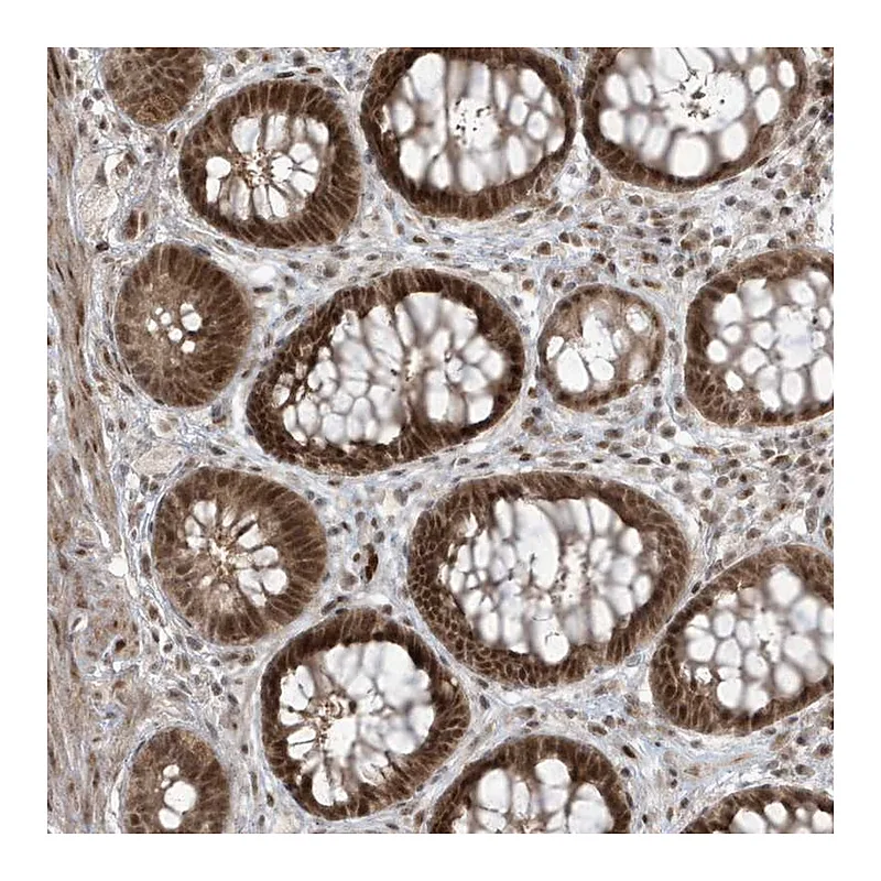Atlas Antibodies Anti-C1orf52 Antibody