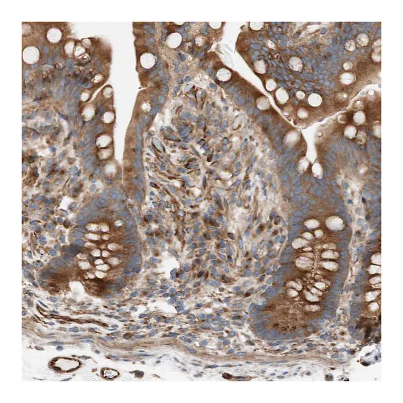 Atlas Antibodies Anti-C1orf43 Antibody