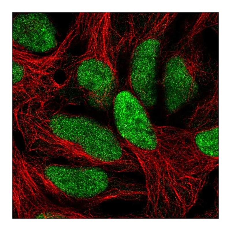 Atlas Antibodies Anti-C1orf52 Antibody