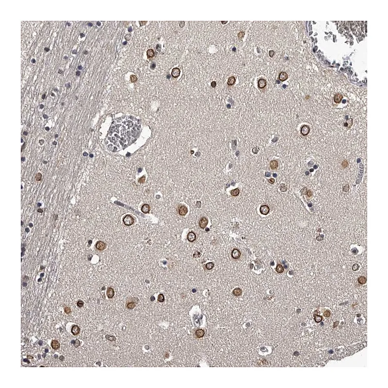 Atlas Antibodies Anti-C1orf50 Antibody