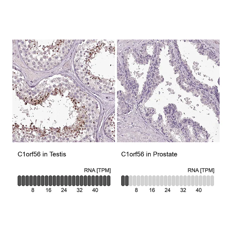 Atlas Antibodies Anti-C1orf56 Antibody