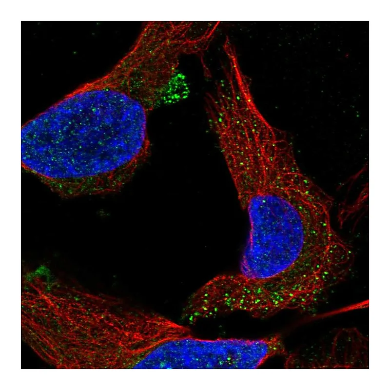 Atlas Antibodies Anti-C1orf53 Antibody