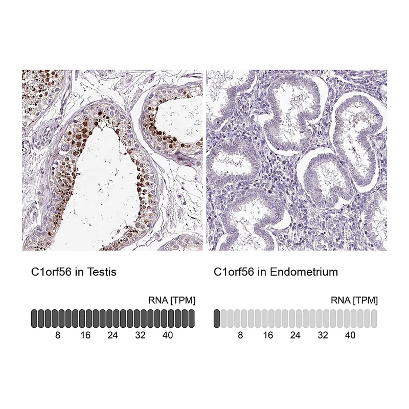 Atlas Antibodies Anti-C1orf56 Antibody