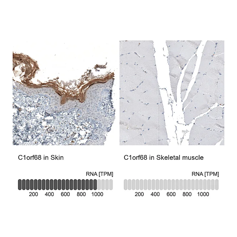 Atlas Antibodies Anti-C1orf68 Antibody