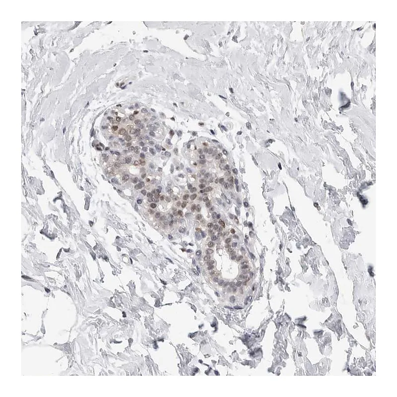 Atlas Antibodies Anti-C1orf64 Antibody