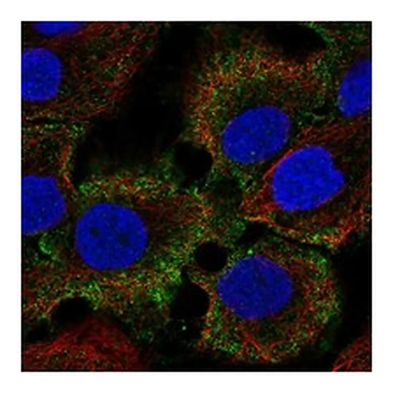 Atlas Antibodies Anti-C1orf68 Antibody
