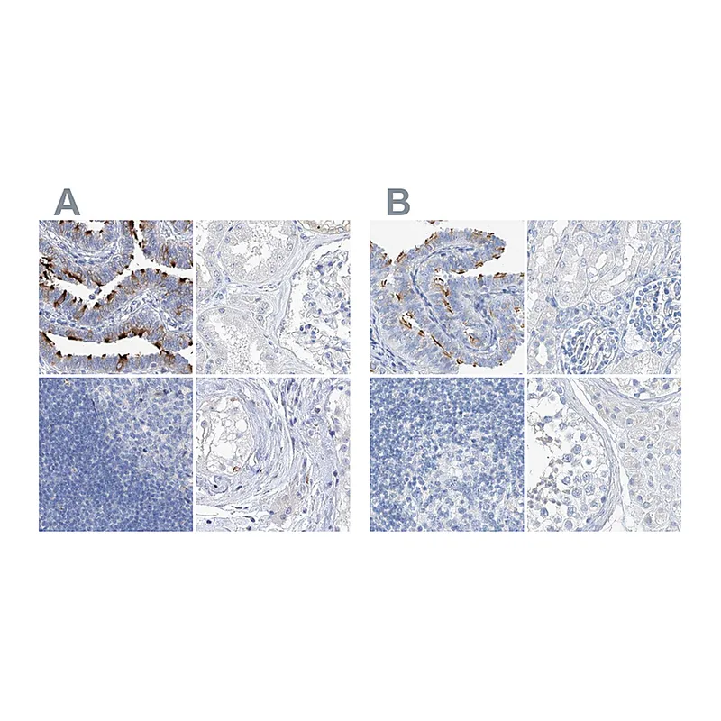 Atlas Antibodies Anti-C1orf87 Antibody