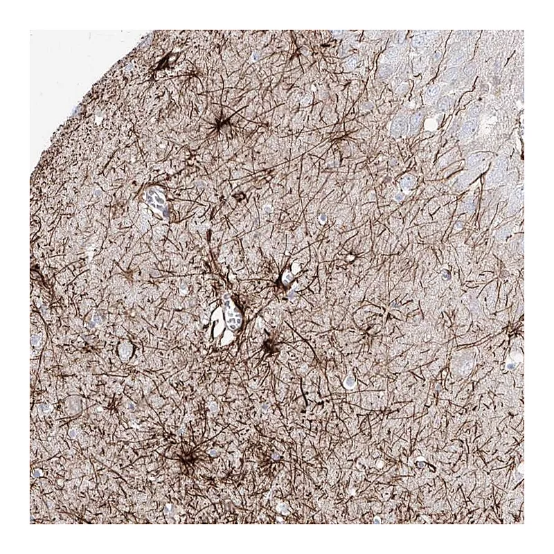 Atlas Antibodies Anti-C1orf74 Antibody